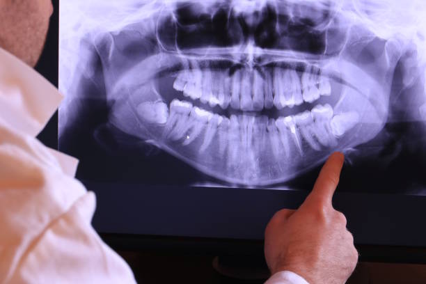 Best Walk-In Emergency Dental Services in Lucerne, CA