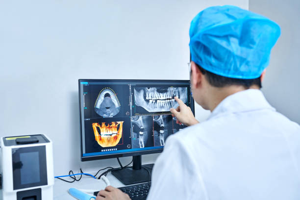 Best Emergency Wisdom Tooth Extraction in Lucerne, CA