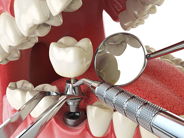 Best Emergency Dental Care for Sports Injuries in Lucerne, CA